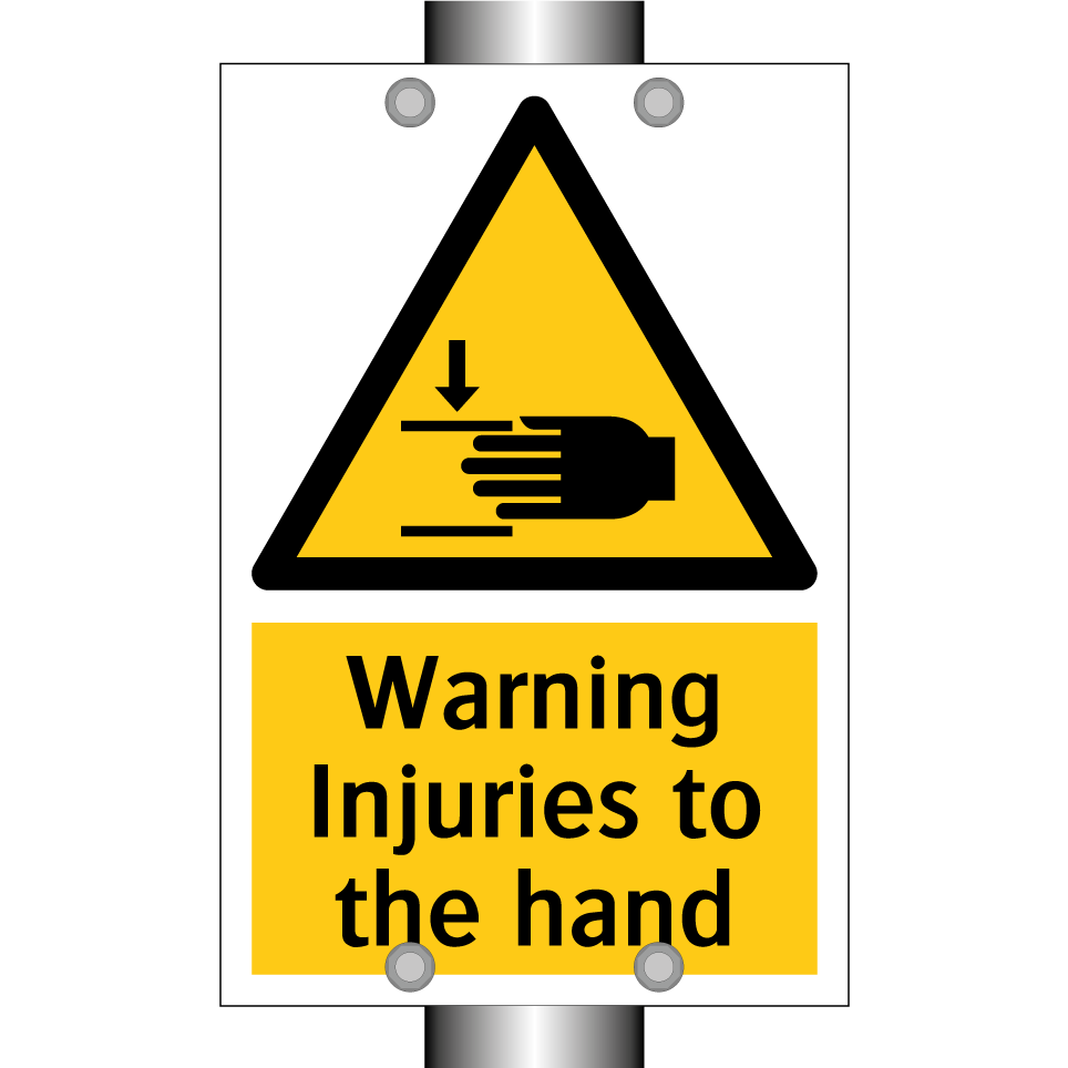 Warning Injuries to the hand