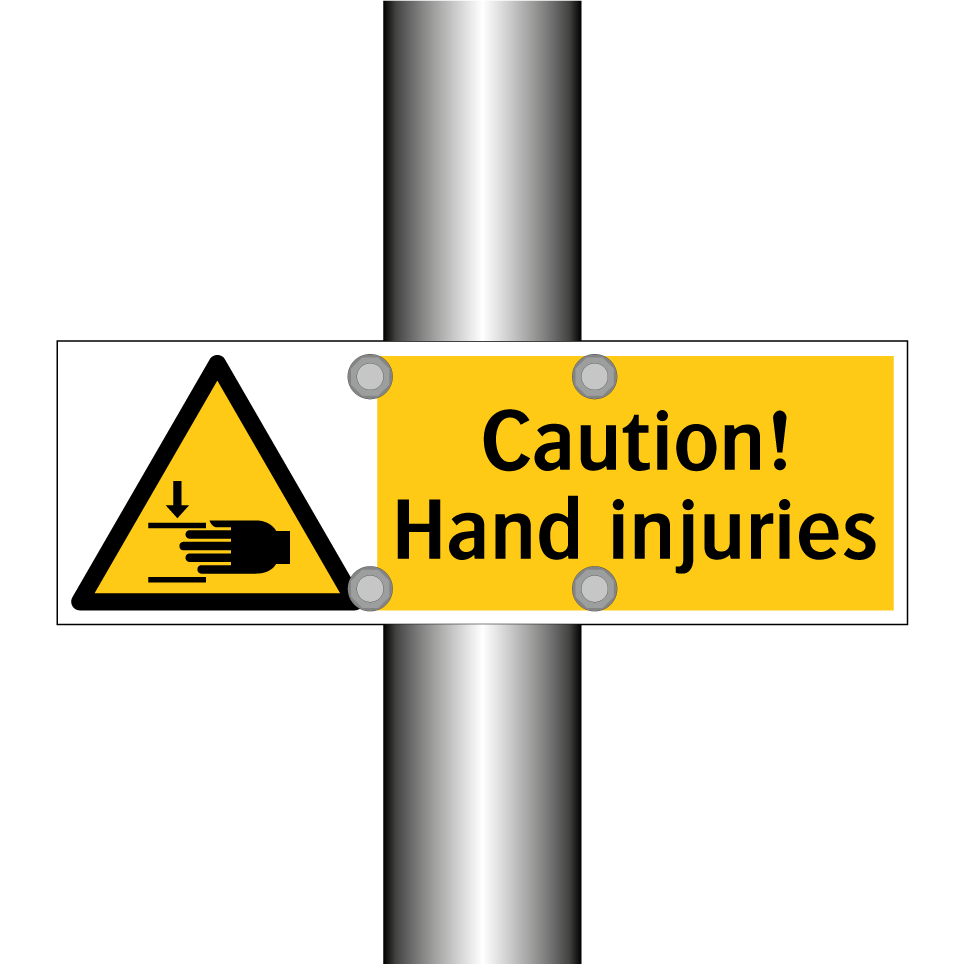 Caution! Hand injuries