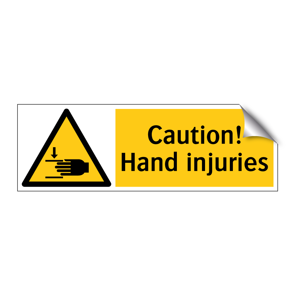 Caution! Hand injuries